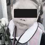 Adulto mayor es atacado por su pitbull en Tizimín, lo habría desconocido